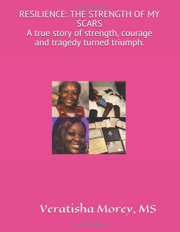 Resilience: the strength of my scars — a true story of courage and triumph