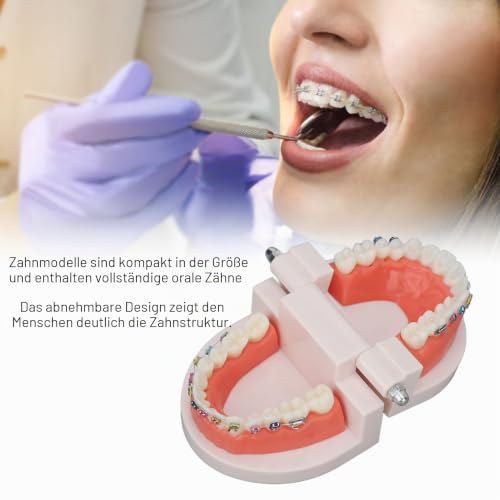 Kieferorthopädisches Zahnmodell, Typodonten Kieferorthopädisches Demonstrationsmodell mit Metalldrähten und Bracket Lehr-, Lern-, Interpretationsmodell für Erwachsene und Kinder