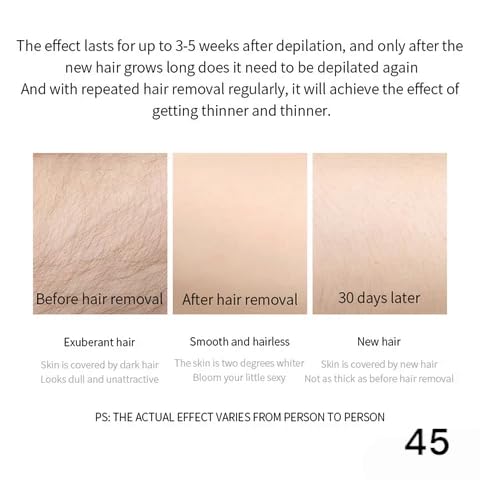 Image of ZeroPathy Ayurvedic Hair Growth Stop cream 35ml - Use After Threading, Shaving or Waxing - Apply After Hair Removal Cream or Spray - 90 Days Permanent Hair Vanish for Face, Legs & Private Areas