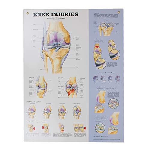 Image of 27046 Health Anatomical Chart Series, Knee Injuries Chart