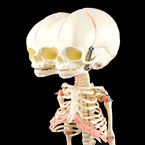 Modèle anatomique de squelette de bébé déformé pour recherche médicale - 5