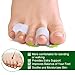 Welnove Gel Toe Separator, Pinky Toe Spacers, Little Toe Cushions for Preventing Rubbing & Relieve Pressure (Pack of 12)