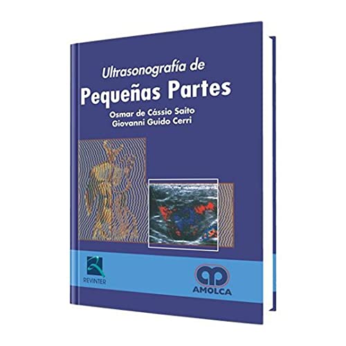 Ultrasonografia de Pequeñas Partes