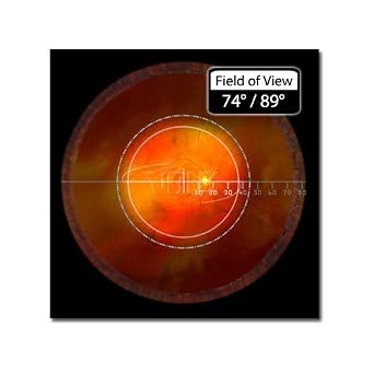Volk 90D Indirect Ophthalmic Slit Lamp Lens - Green