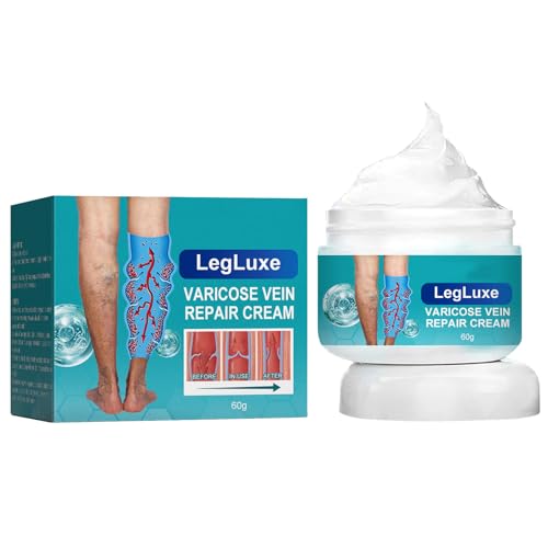 KOAHDE Crema Tratamiento Venas Varicosas,Crema Eliminación Arañas Vasculares,Crema para Varices Piernas,Crema Eliminación de Venas Varicosas,Crema para Eliminar Varices,Crema de Venas Varicosas,1PC