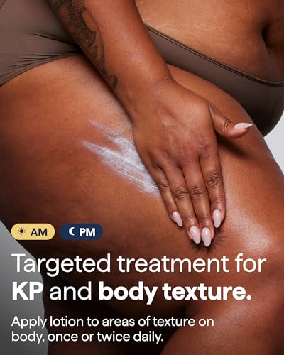 Remedy Science Remedy for Body Bumps | KP Exfoliating Body Moisturizer | Keratosis Pilaris (KP) Treatment For Textured, Crepey Skin with Urea, Lactic Acid, Retinol | Smoothing Body Lotion | By Dermatologist Dr. Shah