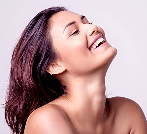 Isispharma - Vitiskin Crema - Idrogel regolatore - Pelle depigmentata - Riduce gli effetti della vitiligine - 50 ml - 4
