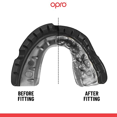Opro Gold Level Ufc Braces Mouthguard, Adults And Junior Sports Mouth Guard, Featuring Revolutionary Fitting Technology For Ufc, Boxing, Mma, Martial Arts, Bjj And All Contact Sports (Black) #TOP3