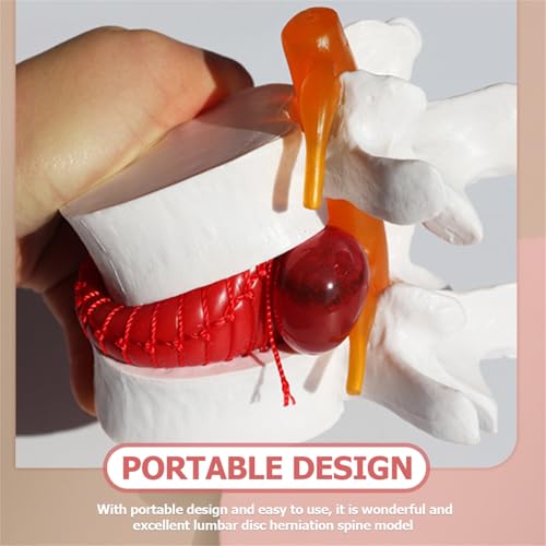 Modèle d'hernie discale lombaire 3D AMITD de haute précision - 5