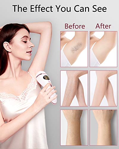 At Home Laser Hair Removal for Women and Men Upgraded to 999,900 Flashes - ProCIV IPL Permanent Hair Removal Painless Hair Remover Device for Whole Body - Thumbnail 5