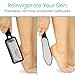 Vive Foot File (3 Pack) - Feet Scraper for Dead Skin - Heel Grater, Callus Remover Scrubber Tool, Rasp for Cracked Heels - Stainless Steel Pedicure Filer for Men & Women - Use on Wet or Dry Skin