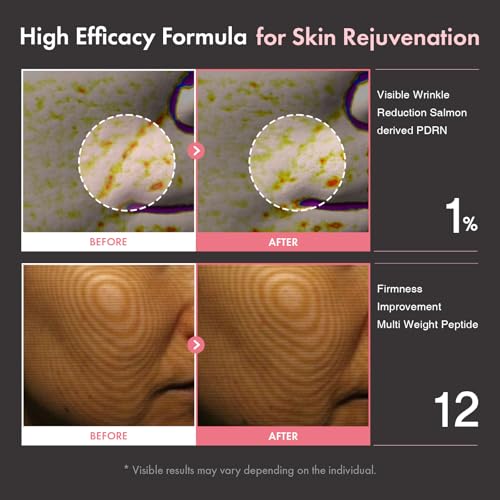 Image of TOSOWOONG PDRN Peptide 12 Capsule Cream, Anti-Aging, Wrinkles, Fine Lines
