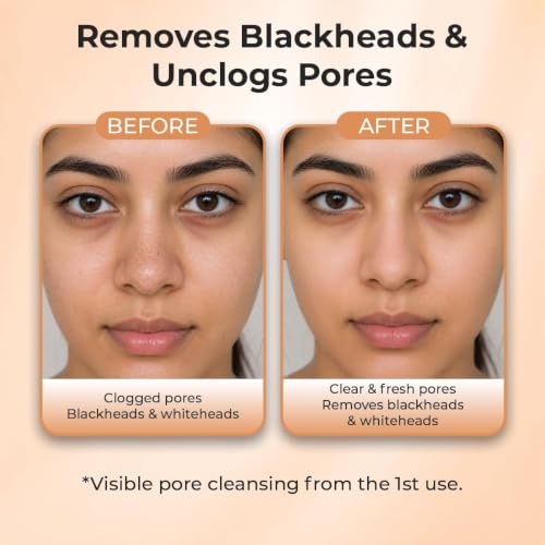 Image of Sanfe Deep Purifying Nose Strips for Women - Pack of 3 with Fuji Green Tea & Witch Hazel extracts | Removes Whiteheads | Blackheads and cleanses pores | Use on Nose (Pack of 2)
