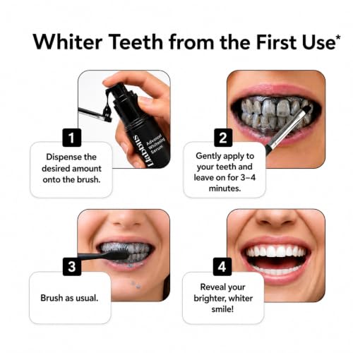 Image of Habbits Instant Teeth Whitening Serum - 30ml | Whiter Teeth From 1st Use | Enamel Safe Instant Teeth Whitener | Peroxide-Free | Tea Coffee Wine Smoking Stain Remover | Natural Charcoal & Peppermint