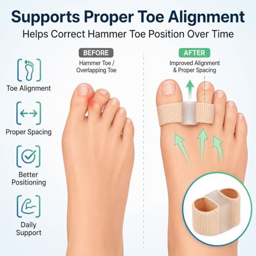 Image of Gel Toe Separators for Bunions(1PCS) - Breathable Fabric Toe Spacers with Gel Lining for Bunion Pain Relief & Hammer Toe Correction - Design for Men & Women (Size S, 1 Pcs)