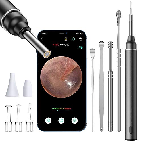 Ear Wax Removal,Ear Wax Removal Tool,Ear Camera 1080P FHD Wireless Ear Otoscope with 6 LED Lights,Ear Scope with Ear Cleaner Tool for iPhone, iPad & Android