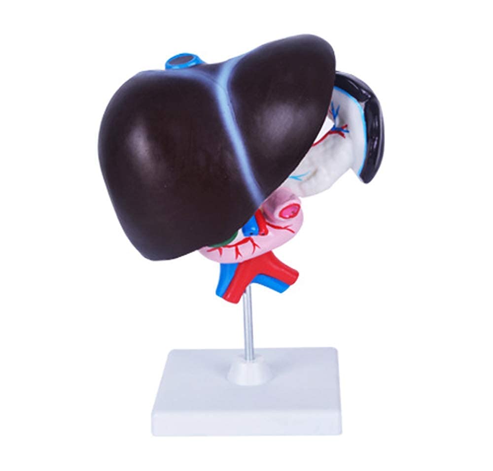 Human Liver Anatomy Model With Pathological Features - Life Size PVC Teaching Display With Base