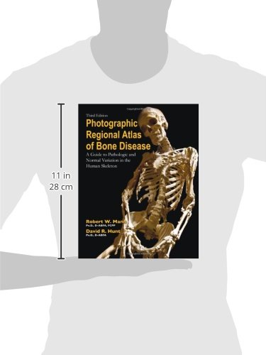 Photographic Regional Atlas of Bone Disease: A Guide to Pathologic and Normal Variation in the Human Skeleton