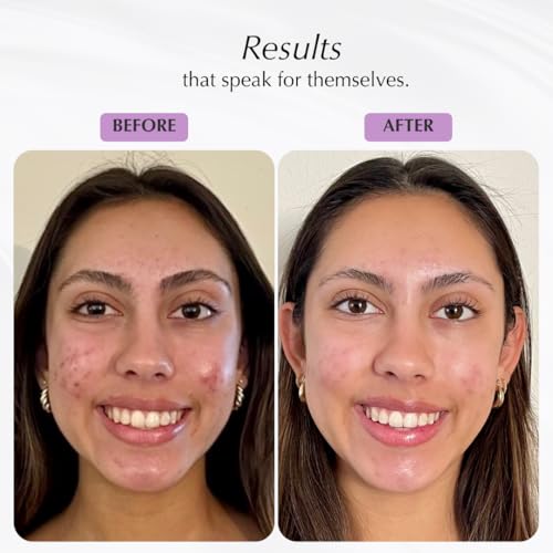 SHIMMER CHEF Honey Lime Polenta, Papaya Purée & Cacao Crème Plaster Mask Trio | Fresh Nutrient-Dense Skincare | Creates Vibrant Skin & Uplifts Mood Through The Shimmer Effect - Image 6