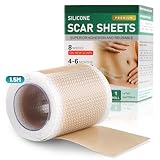 UYUYong Ruban Adhésif en Silicone pour Cicatrices Feuilles de Cicatrices en Silicone Band...