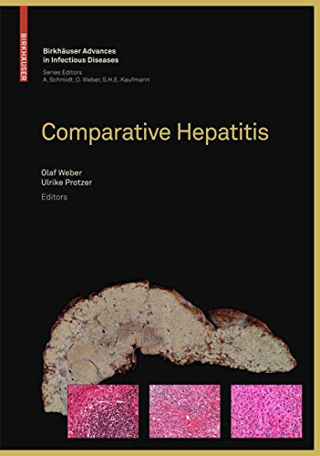 Comparative Hepatitis (Birkhäuser Advances in Infectious Diseases)