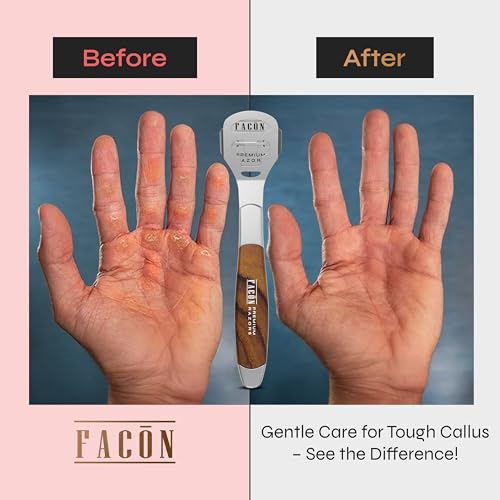 image for FACON Facón Professional Callus Shaver Remover with 50 Blades, Pedicu