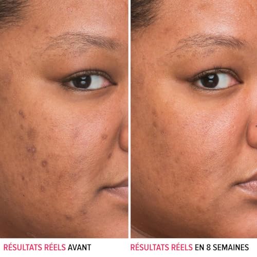 IT Cosmetics Bye Bye Dark Spots 4% Niacinamide Face Serum, view 2