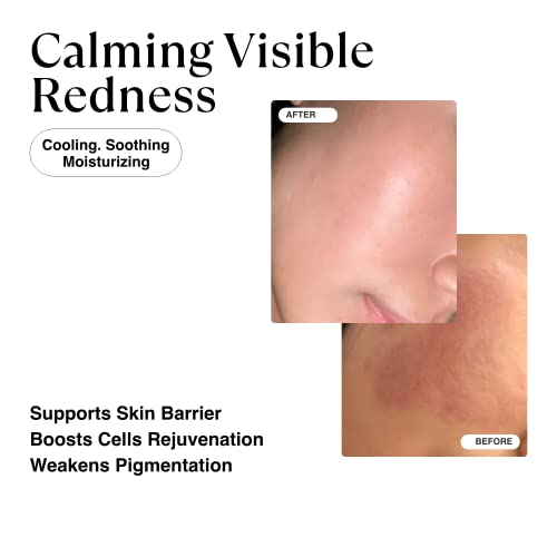 Matkas Korean Dark Spot Remover For Face & Body Serum + Niacinamide + Oat Extract For Deep Correcting Uneven Skin Tone, Brightening Hyperpigmentation Treatment, Dark Spot Corrector Lightening Cream #TOP2