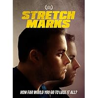 Stretch Marks