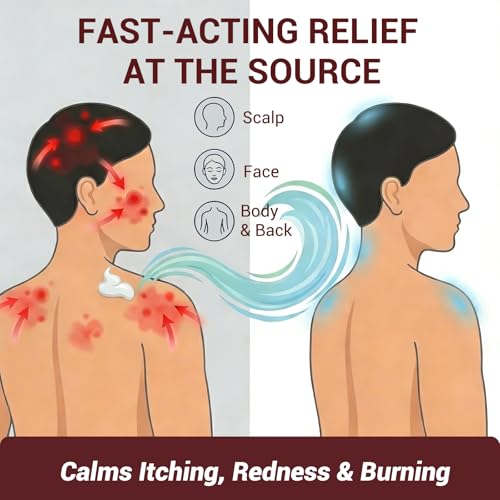 Image of Folliculitis Treatment Cream, 3.52oz | Fast-Acting Relief for Scalp, Face & Body, Soothes Itching, Redness & Inflammation, Natural Colloidal Oatmeal Formula