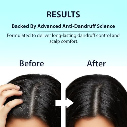 Image of Dermistry Anti-Dandruff Hair Mask with Climbazole Piroctone ZPTO Reduces Dryness Flakes Itching Irritation Exfoliates Both Dry Oily Itchy Scalp Suits Dry Frizzy Curly All Hair Type For Men women 200ml
