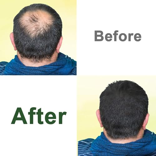 Castor Oil,2 Packs w/Free Lash&Brow Brushes&E-Book,100% Pure Hair Oil for Eyebrow Lash Eyelash Beard Growth Serum Dry Hair Skin Care Essential Oils,Gifts for Women Men Mum Wife Her - Image 5