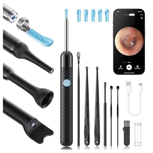 Ear Wax Removal Tool, Ear Cleaner Otoscope with Light, Ear Cleaning Kit with 8 Pcs Ear Set, Earwax Removal Kit with 6 Ear Pick, Ear Camera for iPhone, iPad, Android Phones