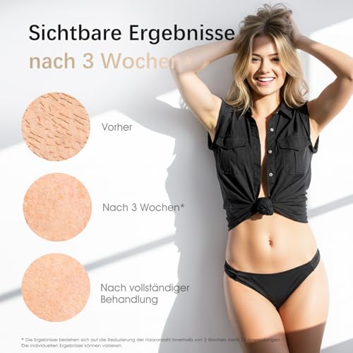 Haarlosy IPL Geräte Haarentfernung Laser für Damen und Herren – 10 °C Eiskühlkontakt zu Hause für Schmerzfreie und Langanhaltende… – Ansicht 3