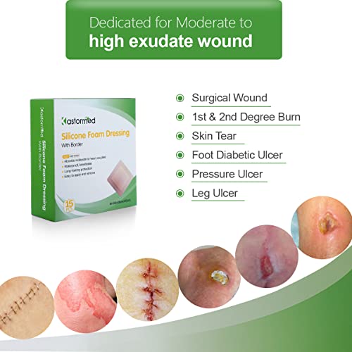 Silicone Adhesive Foam Dressing With Gentle Border 4"X4" 15 Pack, Painless Removal Highly Absorbent Bed Sore Wound Bandage For Leg Ulcer, Foot Diabetic Ulcer Wound Care #TOP1