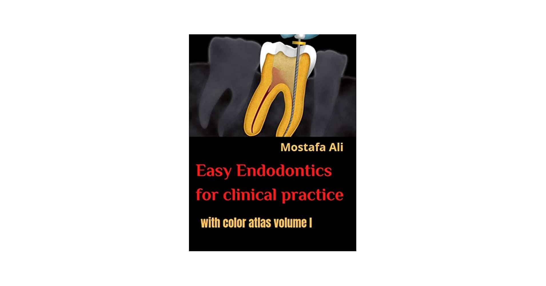 健康・医学 How to Endodontics The State of the Art 健康・医学 How to Endodontics The State of the Art 健康