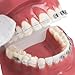 Orthodontic Dental Model with Brackets, YOUYA DENTAL Demonstration Orthodontic Model for Educational, Teeth Demonstration Typodont Anatomic Teaching Tool with 1/2 Metal and 1/2 Ceramic Bracke