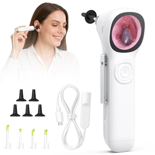 ScopeAround Otoscope with Light, 720P HD Ear Cleaning Camera & 6 LED Lights Ear Scope, 1.45" IPS Display Digital Otoscope, Ear Scope with Extention Cable, Smart Ear Camera, Ready to Use Whit