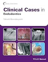 Algopix Similar Product 14 - Clinical Cases in Endodontics Clinical