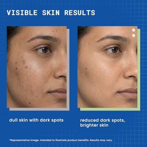 Image of DERMDOC 2% Kojic Acid Glow Fusion Formula Night Cream, 80gm | Niacinamide & Alpha Arbutin | Skin Brightening Face Cream | Reduces Dark Spots & Pigmentation | Even & Glowing Skin