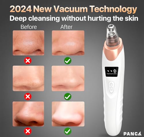 Image of PANCA 5-in-1 Blackhead Remover Machine | Electric Pore Cleaner & Whitehead Removal Tool | USB Rechargeable Skin Care Device for Face Cleansing & Exfoliation (Black)