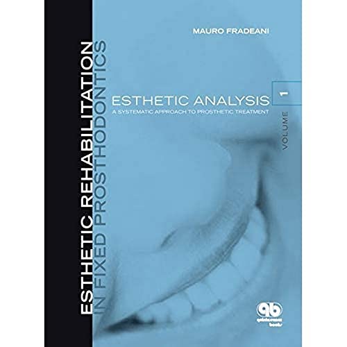 Esthetic Rehabilitation In Fixed Prosthodontics: Esthetic Analysis: A Systematic Approach To Prosthetic Treatment #TOP10