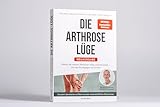 Zoom IMG-2 die arthrose l ge neuausgabe Zoom IMG-2 die arthrose l ge neuausgabe