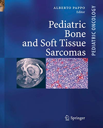 Pediatric Bone and Soft Tissue Sarcomas (Pediatric Oncology)
