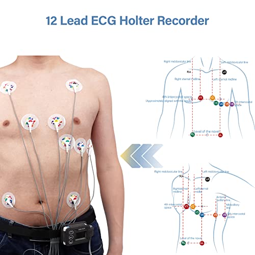Wellue Holter ECG Monitor, Professional 12 Lead ECG Monitors, 24-Hour ECG Holter Record With AI Analysis, Work With Mac & Windows PDF Report Export, Portable Heart Monitor For Home Use