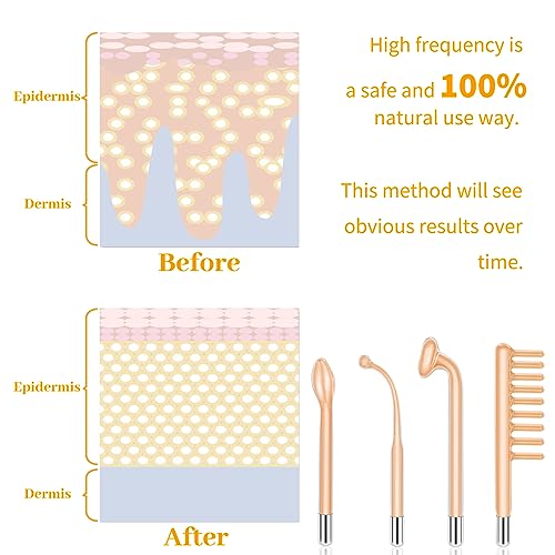MYSWEETY High F Rrequncy Portable Handheld Facial Skin Care Wand Machine