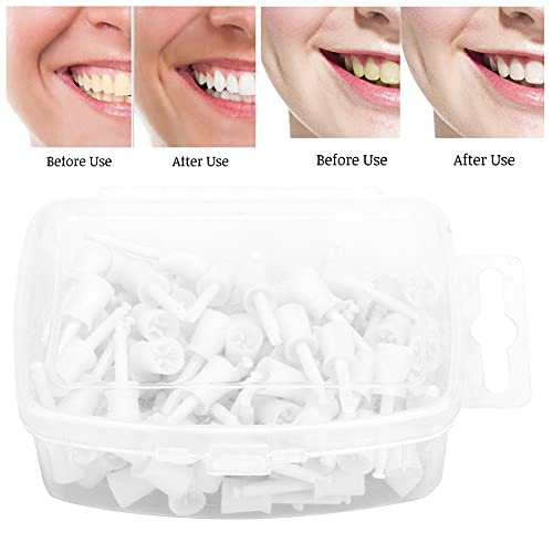 Glomora GLOMORAO3EXSC0YRF 100Pcs Box Disposable Dental Polishing Cup,Dental Prophy Cups,Dental Materials Dental Accessory thumb #3