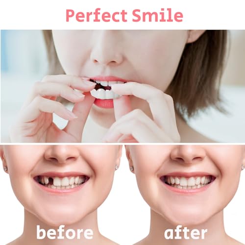 Image of 2 Pairs Temporary Smile Support Adjustable for All Genders, Top and Bottom, Temporarily Adjustable for Men and Women, Regain Confidence