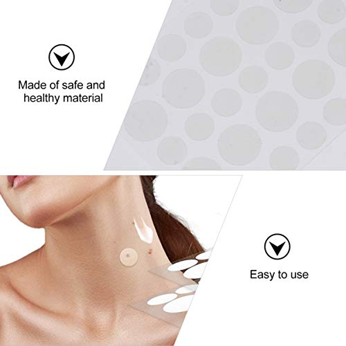 ARTIBETTER 108Pcs Adesivos de Pele E Adesivos de Remoção de Acne Adesivos Removedor de Verrugas Remo