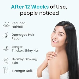 myUpchar Biotin+ Supplement with Vitamin C, Zinc, Iron & Niacinamide | Suplement for Strong & Thick Hair, Biotin Tablets for Hair Growth | Brightens Skin, Strengthens Hair & Nails | Veg Tablets - 60